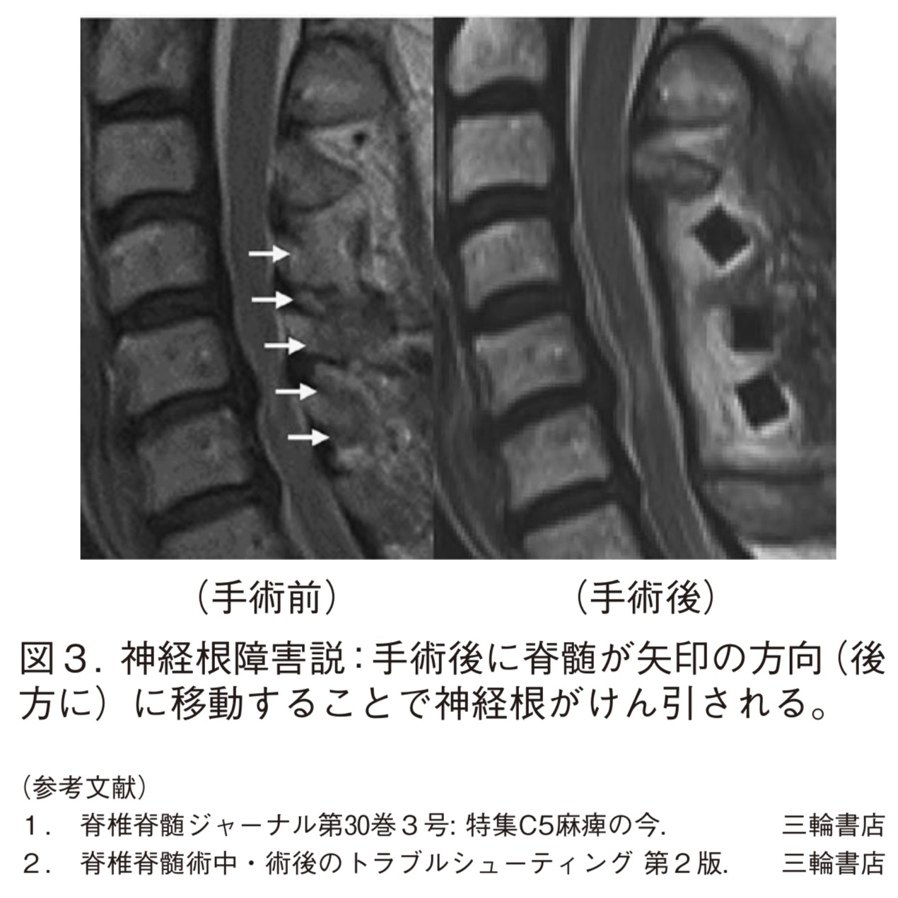 脊椎便り 第9号 | 佐賀大学医学部 整形外科学教室