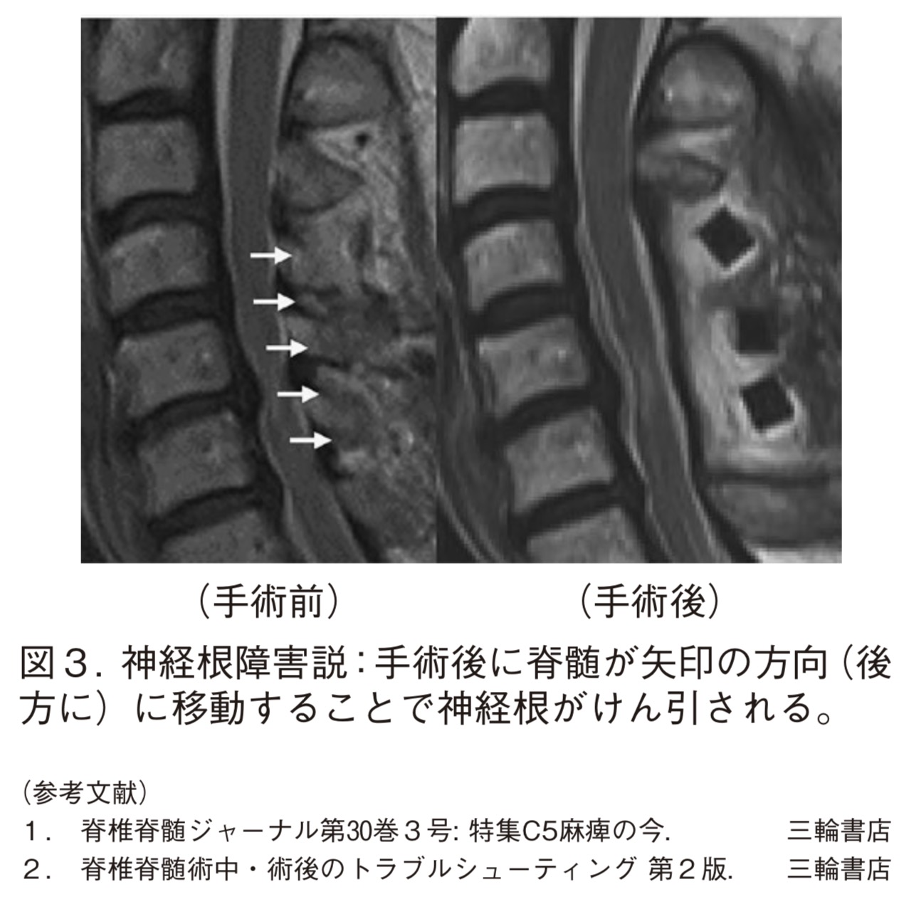 脊椎便り 第9号 佐賀大学医学部 整形外科学教室