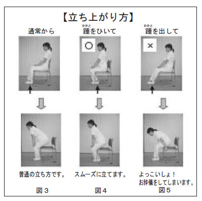 脱臼の話 刊行紙のご案内