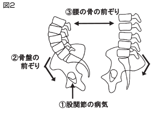 と 腰 痛い 病気 てる が 寝